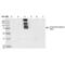 Arginyl Aminopeptidase Like 1 antibody, NBP2-59371, Novus Biologicals, Western Blot image 