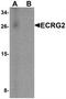 Serine Peptidase Inhibitor, Kazal Type 7 (Putative) antibody, TA320055, Origene, Western Blot image 