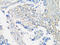 Matrix Metallopeptidase 2 antibody, LS-C746891, Lifespan Biosciences, Immunohistochemistry paraffin image 