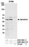 Aprataxin antibody, A300-148A, Bethyl Labs, Immunoprecipitation image 