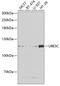 Ubiquitin Protein Ligase E3C antibody, 22-225, ProSci, Western Blot image 