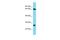 Chromosome 22 Open Reading Frame 23 antibody, A17201, Boster Biological Technology, Western Blot image 