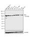 Hexokinase 2 antibody, PA5-29326, Invitrogen Antibodies, Western Blot image 