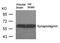 Synaptotagmin 1 antibody, 79-609, ProSci, Western Blot image 