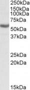 Aldehyde Dehydrogenase 3 Family Member B1 antibody, TA311137, Origene, Western Blot image 