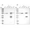 Aldehyde Dehydrogenase 6 Family Member A1 antibody, NBP1-82636, Novus Biologicals, Western Blot image 