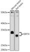 NAD-dependent ADP-ribosyltransferase sirtuin-4 antibody, GTX33501, GeneTex, Western Blot image 