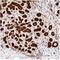 Mitogen-Activated Protein Kinase 1 antibody, NB110-60506, Novus Biologicals, Immunohistochemistry paraffin image 