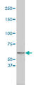 Tyrosinase antibody, LS-C133504, Lifespan Biosciences, Western Blot image 