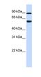 Alcohol Dehydrogenase Iron Containing 1 antibody, orb330694, Biorbyt, Western Blot image 