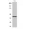 Mitogen-Activated Protein Kinase Kinase 3 antibody, LS-C380774, Lifespan Biosciences, Western Blot image 