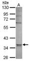 Glycerol-3-Phosphate Dehydrogenase 1 antibody, NBP2-16688, Novus Biologicals, Western Blot image 