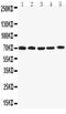 Potassium Voltage-Gated Channel Subfamily A Member 4 antibody, LS-C313389, Lifespan Biosciences, Western Blot image 