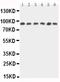 Signal Transducer And Activator Of Transcription 5B antibody, PA1841, Boster Biological Technology, Western Blot image 