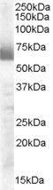 Cytochrome P450 Family 17 Subfamily A Member 1 antibody, PA5-18504, Invitrogen Antibodies, Western Blot image 
