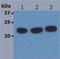 HRas Proto-Oncogene, GTPase antibody, NB110-68799, Novus Biologicals, Western Blot image 