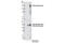 Ring Finger Protein 40 antibody, 12187S, Cell Signaling Technology, Western Blot image 