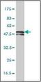 Keratin 81 antibody, orb89634, Biorbyt, Western Blot image 