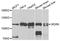 WD Repeat Domain 6 antibody, A7780, ABclonal Technology, Western Blot image 