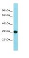 LSM Family Member 14B antibody, orb325780, Biorbyt, Western Blot image 