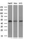 Protein kinase C and casein kinase substrate in neurons protein 3 antibody, MA5-25366, Invitrogen Antibodies, Western Blot image 