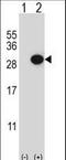 Collagen Triple Helix Repeat Containing 1 antibody, LS-C167129, Lifespan Biosciences, Western Blot image 