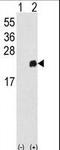 Peroxiredoxin 1 antibody, LS-C162124, Lifespan Biosciences, Western Blot image 