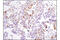 Polo Like Kinase 1 antibody, 4513T, Cell Signaling Technology, Immunohistochemistry paraffin image 