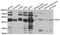 Chimerin 1 antibody, A7546, ABclonal Technology, Western Blot image 