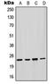 Glutathione S-transferase Mu 2 antibody, LS-C352286, Lifespan Biosciences, Western Blot image 