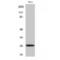 TNF Superfamily Member 13 antibody, LS-C382090, Lifespan Biosciences, Western Blot image 