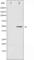 Activating Transcription Factor 2 antibody, abx012097, Abbexa, Western Blot image 