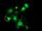 Four And A Half LIM Domains 1 antibody, MA5-25135, Invitrogen Antibodies, Immunocytochemistry image 