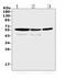 Aldehyde Dehydrogenase 1 Family Member A3 antibody, A03030, Boster Biological Technology, Western Blot image 