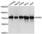 Lysyl-TRNA Synthetase antibody, A02479-1, Boster Biological Technology, Western Blot image 