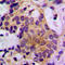 Protein Tyrosine Phosphatase Non-Receptor Type 11 antibody, LS-C354077, Lifespan Biosciences, Immunohistochemistry paraffin image 