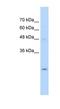 Ubiquitin Conjugating Enzyme E2 K antibody, NBP1-54914, Novus Biologicals, Western Blot image 