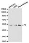 Coagulation Factor III, Tissue Factor antibody, LS-C192767, Lifespan Biosciences, Western Blot image 
