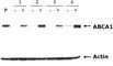 ATP Binding Cassette Subfamily A Member 1 antibody, ab18180, Abcam, Western Blot image 