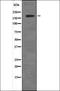 ALK Receptor Tyrosine Kinase antibody, orb336007, Biorbyt, Western Blot image 