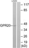 G Protein-Coupled Receptor 20 antibody, A14205, Boster Biological Technology, Western Blot image 