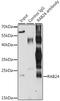 Ras-related protein Rab-24 antibody, 23-551, ProSci, Immunoprecipitation image 