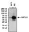 GATA Binding Protein 3 antibody, GTX30600, GeneTex, Western Blot image 