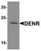 Density Regulated Re-Initiation And Release Factor antibody, A06362, Boster Biological Technology, Western Blot image 