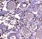 Fatty acid-binding protein, epidermal antibody, A02083, Boster Biological Technology, Immunohistochemistry frozen image 