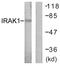 Interleukin 1 Receptor Associated Kinase 1 antibody, LS-C117657, Lifespan Biosciences, Western Blot image 