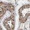 GDNF Family Receptor Alpha 3 antibody, NBP1-89774, Novus Biologicals, Immunohistochemistry paraffin image 