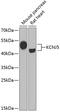 G protein-activated inward rectifier potassium channel 4 antibody, 22-070, ProSci, Western Blot image 