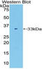 Alpha-L-Fucosidase 1 antibody, LS-C294168, Lifespan Biosciences, Western Blot image 