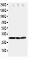Catechol-O-Methyltransferase antibody, LS-C313303, Lifespan Biosciences, Western Blot image 